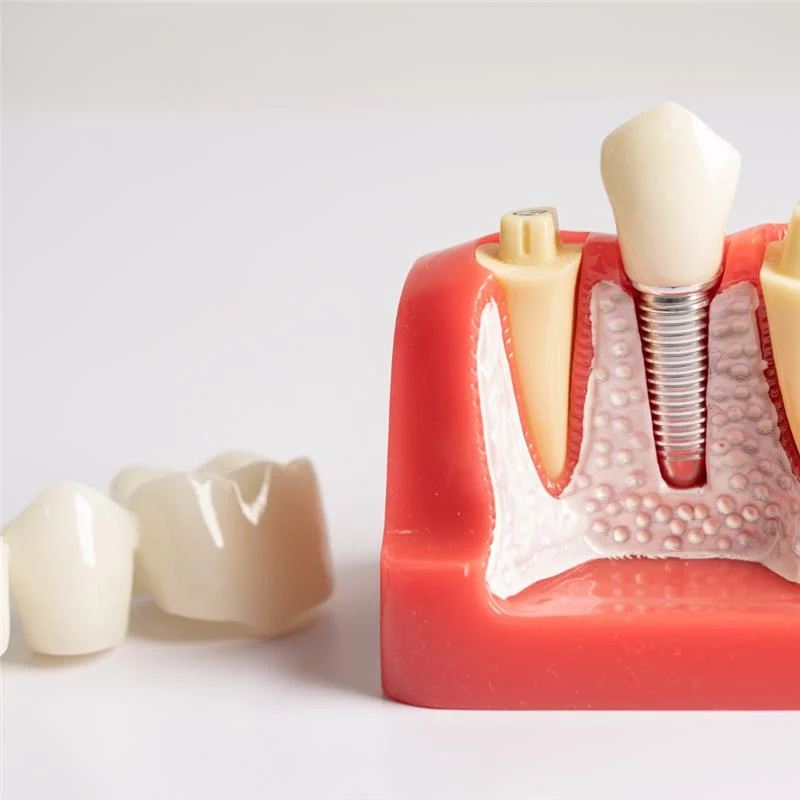 Does Scaling and Root Planning Hurt?