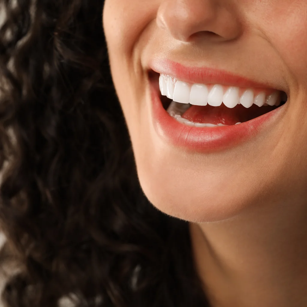 Should I skip Invisalign and jump directly to the cosmetic veneer