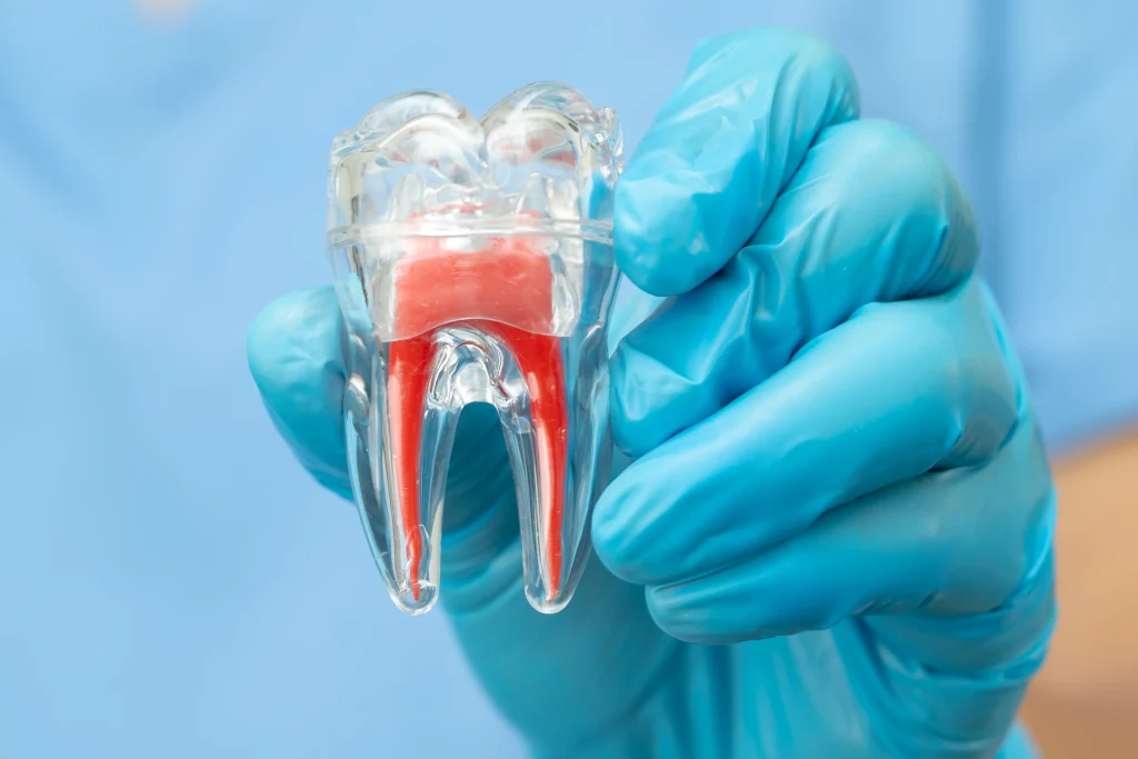 How to Avoid a Root Canal: A Dentist’s Daily Guide