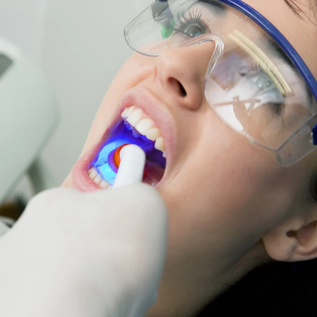 Best Foods to Eat After Dental Fillings